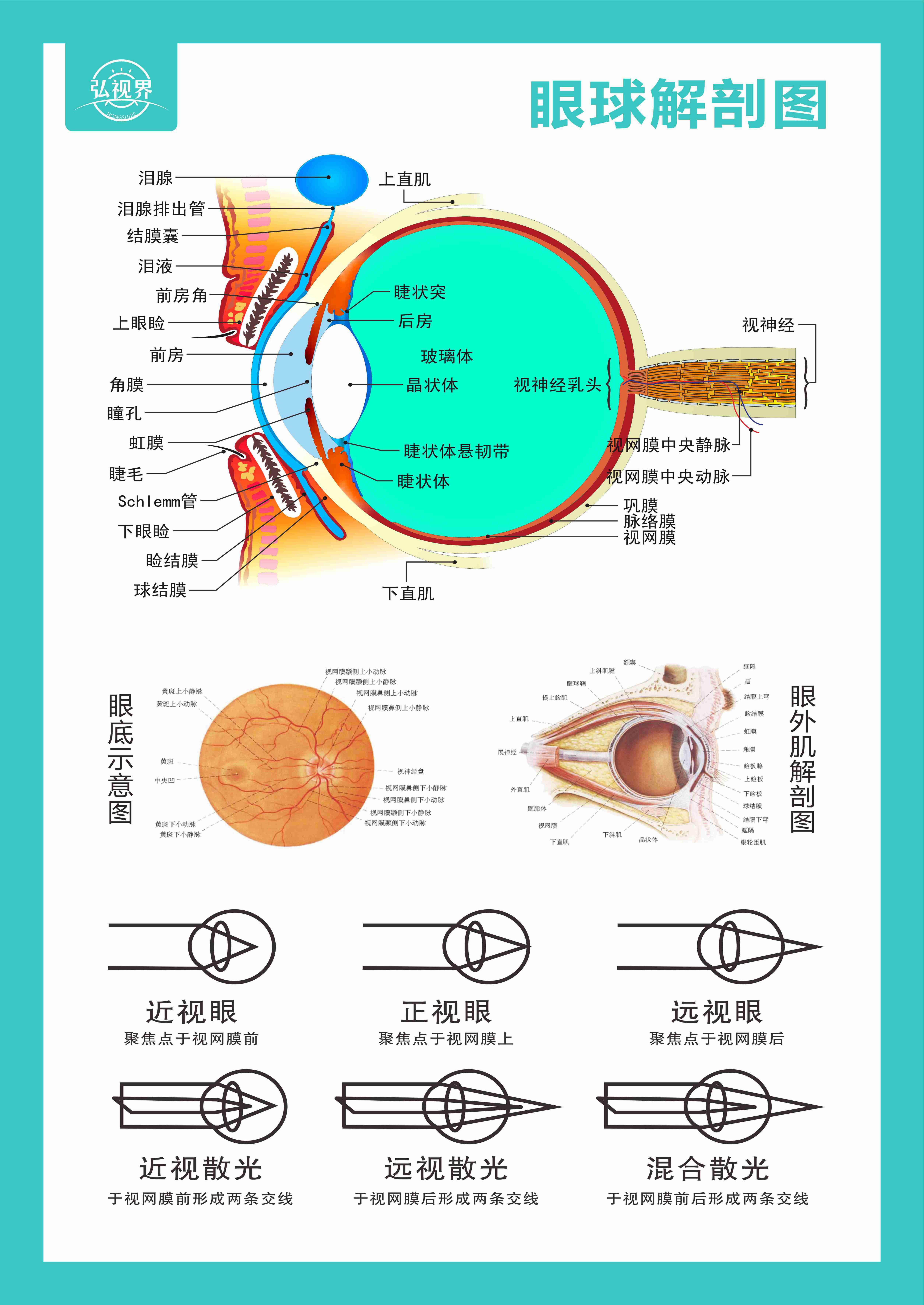 治疗近视产品